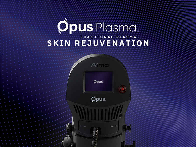 Opus Plasma in Terre Haute IN