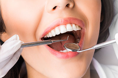 Periodontal Surgery in Terre Haute IN