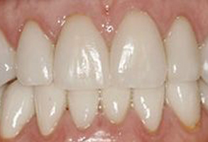 Cosmetic Dentist near Terre Haute IN